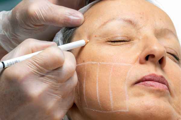 CryoPen: 5 Skin Concerns It May Be Used to Treat 4 What should you ask before having CryoPen treatment Leeds?