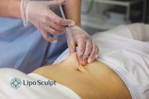 Does Skin Sag After Fat Dissolving Injections? 2 Do you want to get Aqualyx fat dissolving injections Leeds but worried about loose skin afterwards?