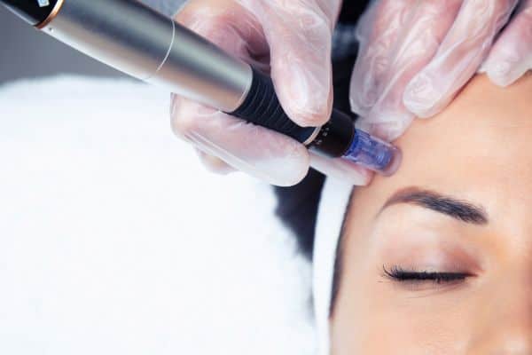Explaining Total Skin Tightening Treatment and What to Expect 2 What Skin Concerns Can Total Skin Tightening Treatment Help With Leeds?