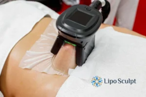 Does Fat Freezing At Home Work? 3 Fat freezing at home from Lipo Sculpt Leeds